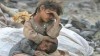 آمار هولناک از ۸ سال تجاوزگری سعودی‌ها علیه مردم یمن